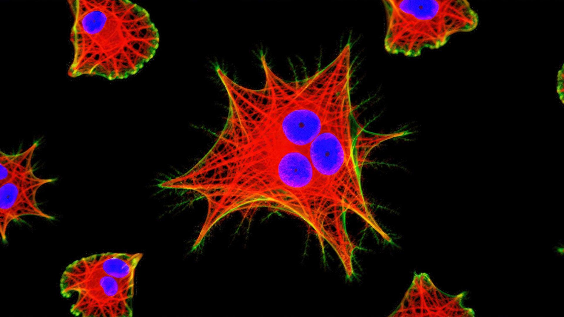 Human brain giloma cells