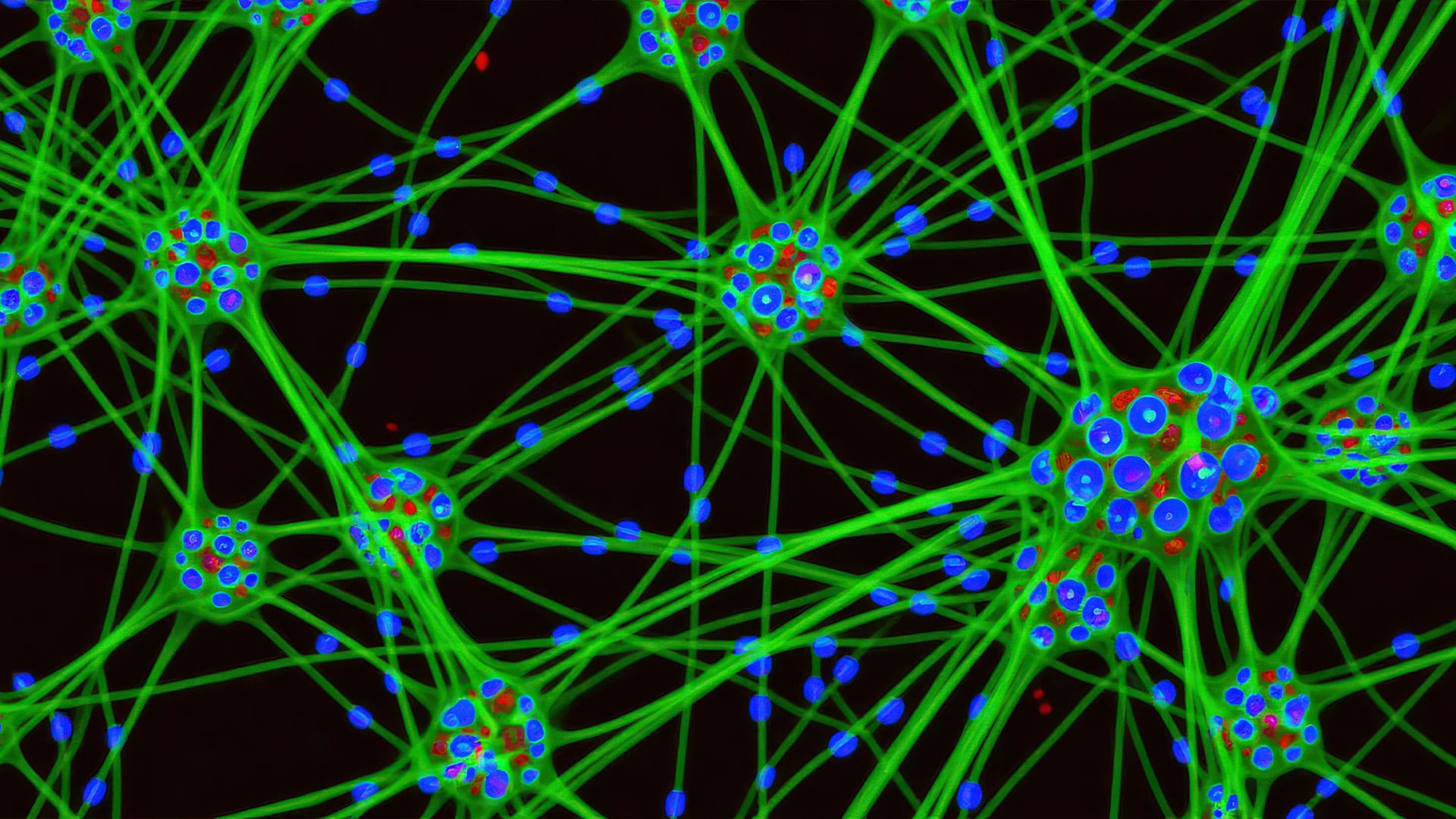 Brain cells