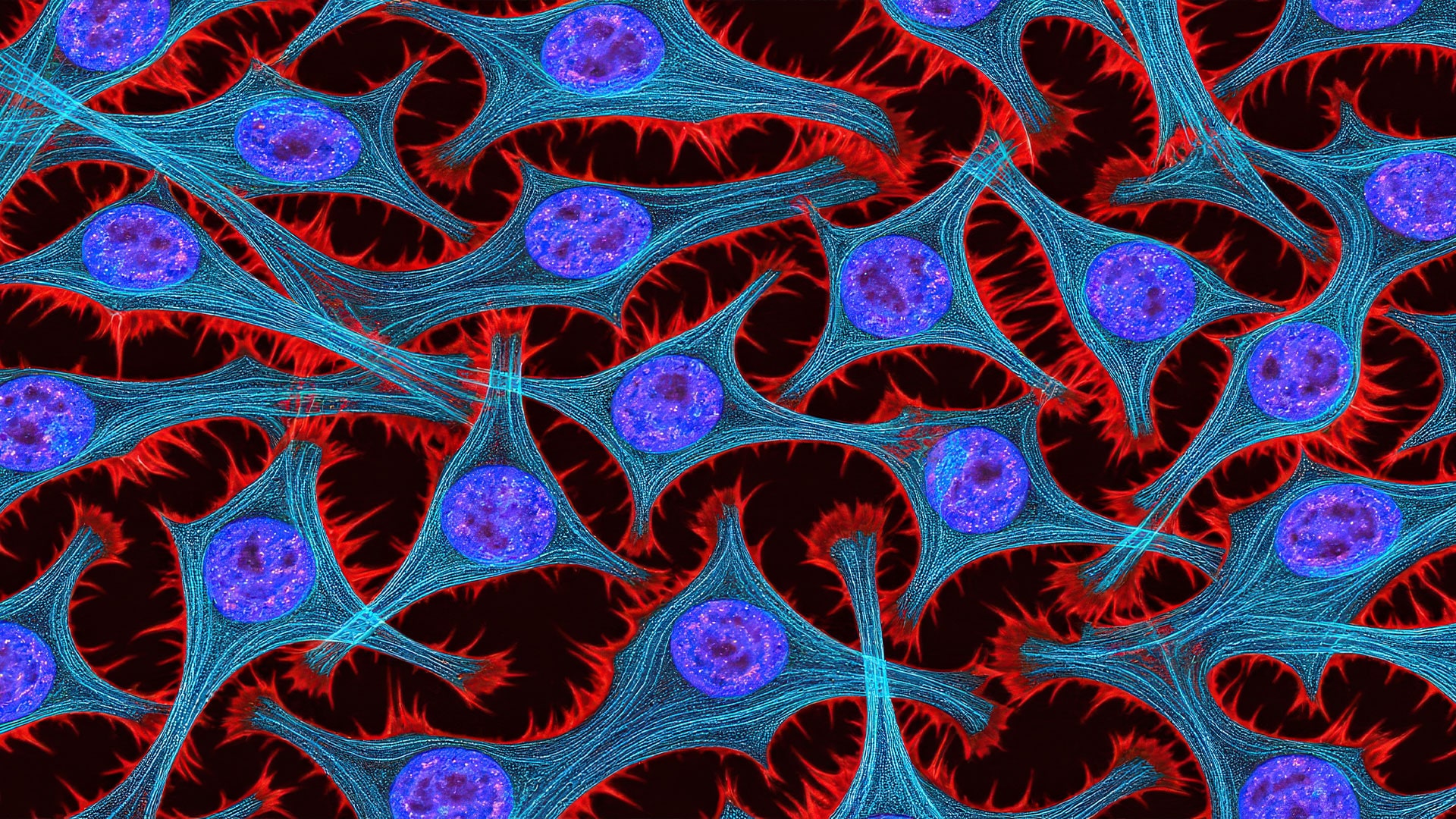 HeLa cells